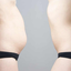 A diástase abdominal é a principal causa de flacidez abdominal - Reprodução: Pinterest