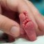 Imagem Novembro Roxo: Mês de sensibilização da prematuridade