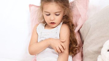 Imagem Crianças são as que mais sofrem com dermatite atópica