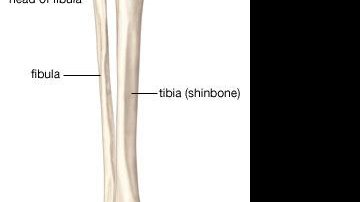 Imagem HEMIMELIA FIBULAR E O TRABALHO DA AACD