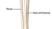 Imagem HEMIMELIA FIBULAR E O TRABALHO DA AACD