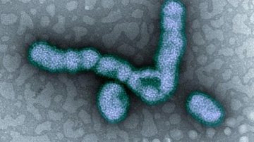 Imagem Qual é a diferença da gripe comum para a H1N1?