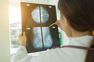 Imagem Mamografias caem 46,4% na rede privada durante a pandemia