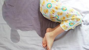 Imagem Punição atrapalha a melhora dos casos de xixi na cama