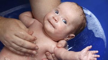 Imagem Entenda a fimose fisiológica, condição normal em recém-nascidos