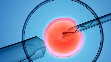 Reprodução humana de maneira assistida