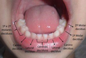 dentes-molares